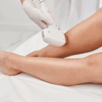 Cuantas-sesiones-de-laser-se-necesitan-para-las-piernas